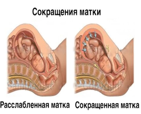 Сокращение матки после родов: сколько дней сокращается матка после родов, как долго это происходит и что делать для более быстрого восстановления?